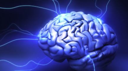 Image of brain stimulation