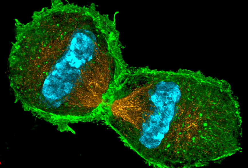 How do biomembranes form micro-structures in our cells? | Mathematical
