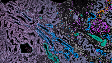 Mathematical methods reveal complex cell patterns in high-resolution kidney data