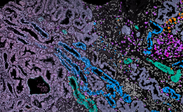 Mathematical methods reveal complex cell patterns in high-resolution kidney data