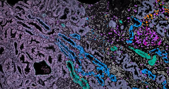 Mathematical methods reveal complex cell patterns in high-resolution kidney data Mathematical methods reveal complex cell patterns in high-resolution kidney data